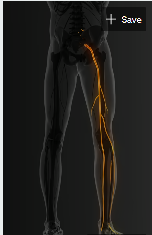 Sciatica and nerve pain