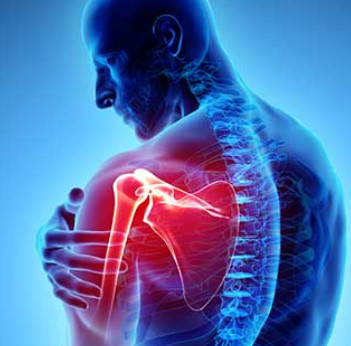 Shoulder pain and rotator cuff pain